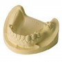 Dental Clas3
